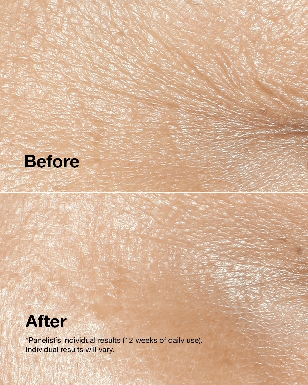 Clinique Smart Clinical Repair™ Wrinkle Correcting Cream