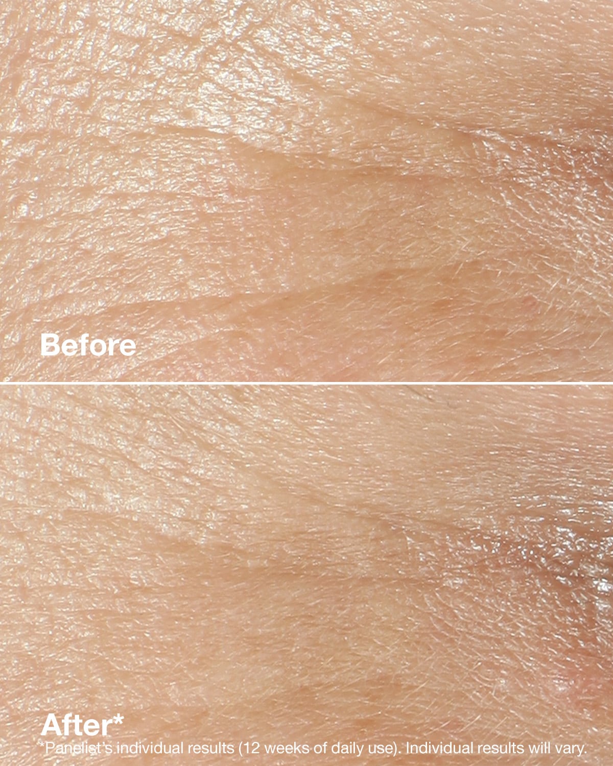 Clinique Smart Clinical Repair™ Wrinkle Correcting Rich Cream