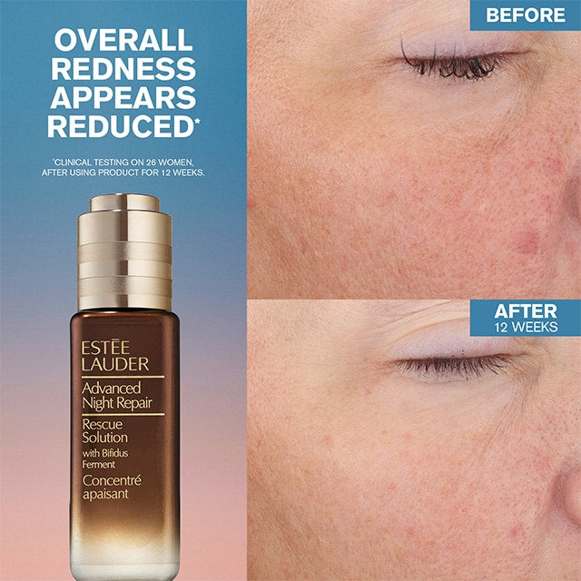 Advanced Night Repair Rescue Solution Serum